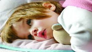اقدامات درمانی به هنگام مسمومیت کودک کدام است؟