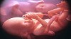 لگد زدن جنین چیست و چقدر باید باشد؟