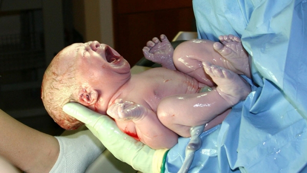 خصوصیات نوزاد هنگام تولد
